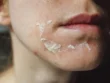 Peel da