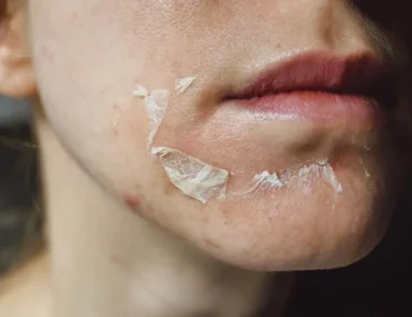 Peel da