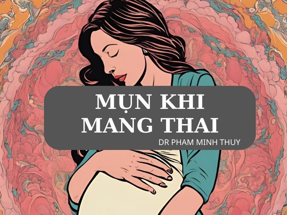 Cách Điều Trị Mụn Trứng Cá Khi Mang Thai An Toàn