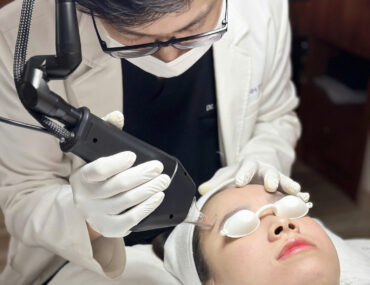 Trị sẹo rỗ sớm